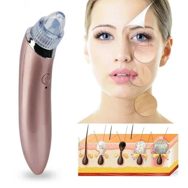 Vacuum facial pore cleaner XN-8030