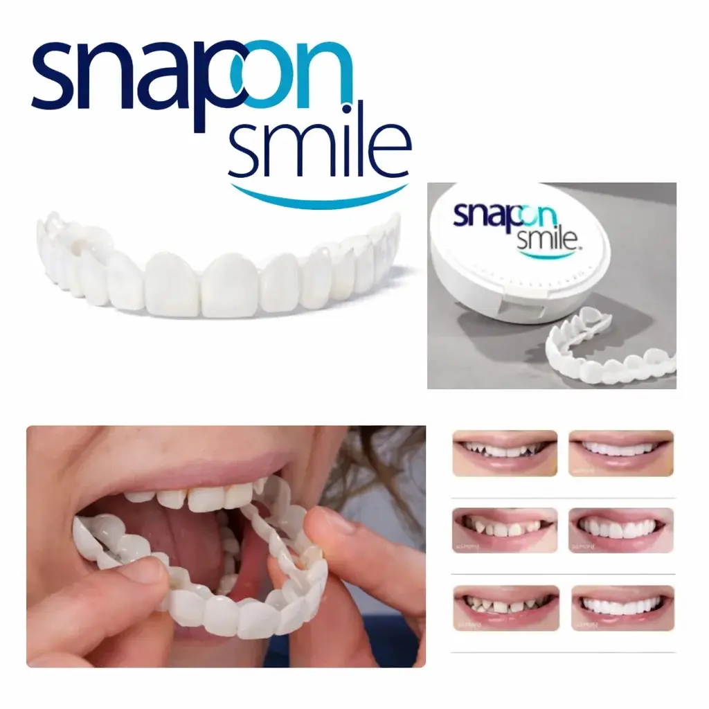 Знімні вініри для зубів Snap On Smile на 2 щелепи • Накладні вініри на верхню та нижню щелепу для красивої усмішки